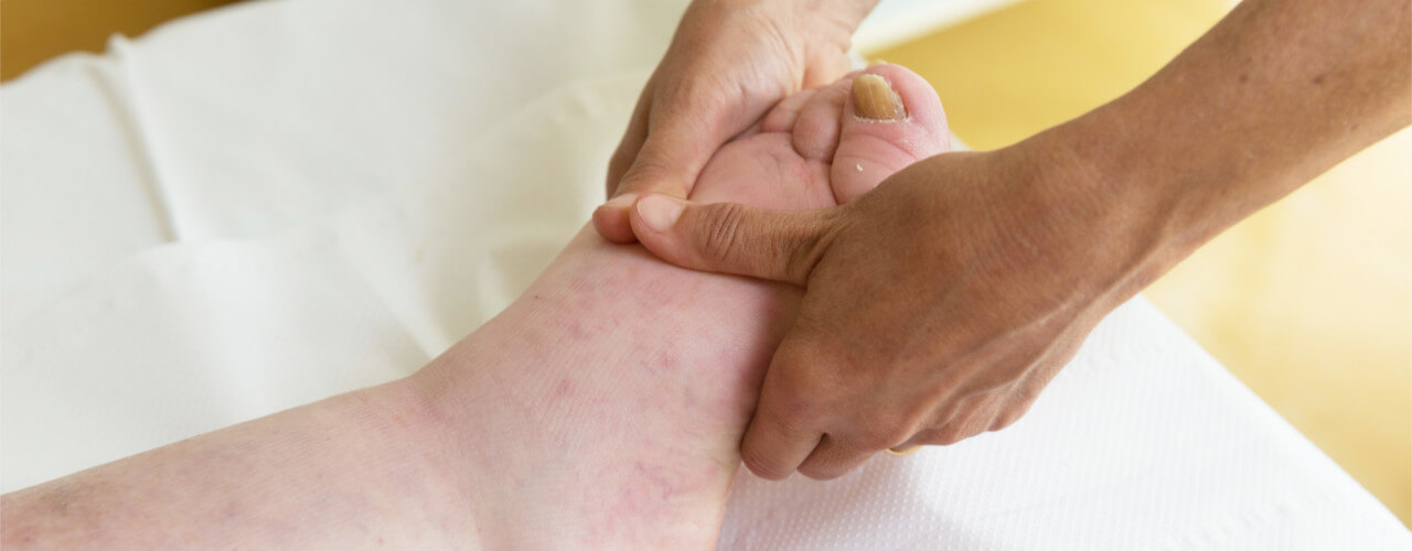 Lymphedema Crookston, Hibbing, Bagley, Bemidji, Blackduck, Gonvick, Kelliher, MN